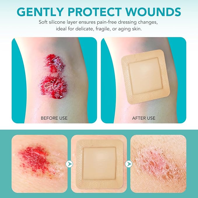 Silicone Foam Dressing Ag Sterile Wound Bandage with Waterproof Gentle Silicone Adhesive Border (5 Packs), 4"x 4" Breathable Ultra Absorbent Pads (4x4 Inch (Pack of 5))