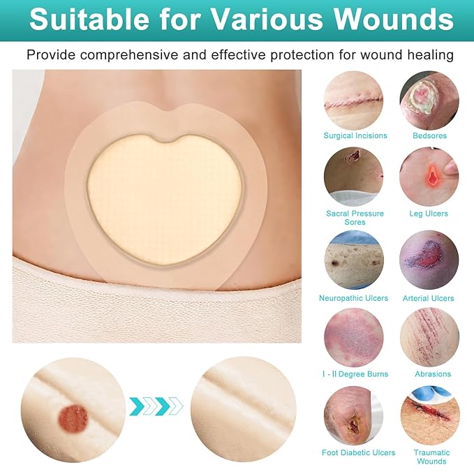 Adhesive Border 7"x7", 5 Packs, Highly Absorbent, Breathable Waterproof Sacral Bandage Pad for Bed Sore, Pressure Ulcer Wound Dressing